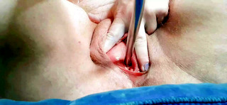 FtM Slide Grant fucks his pee hole with medical sounding rods outside on a beautiful summer’s day